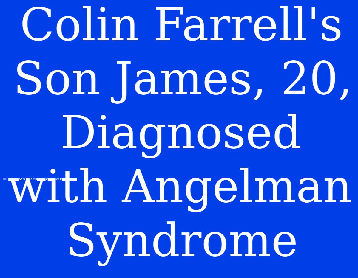 Colin Farrell's Son James, 20, Diagnosed With Angelman Syndrome