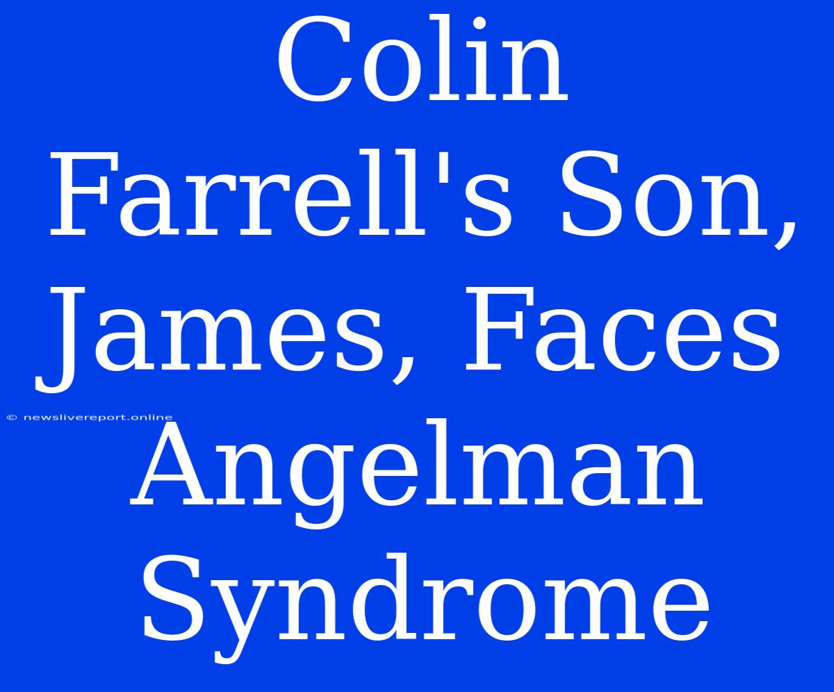 Colin Farrell's Son, James, Faces Angelman Syndrome